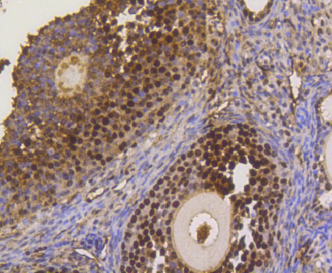 Paraformaldehyde-fixed and paraffin-embedded Mouse ovary tissue incubated with ASH2L (1B6) Monoclonal Antibody (bsm-52448R) at 1:300, overnight at 4°C, followed by a conjugated secondary antibody and DAB staining. Counterstained with hematoxylin.