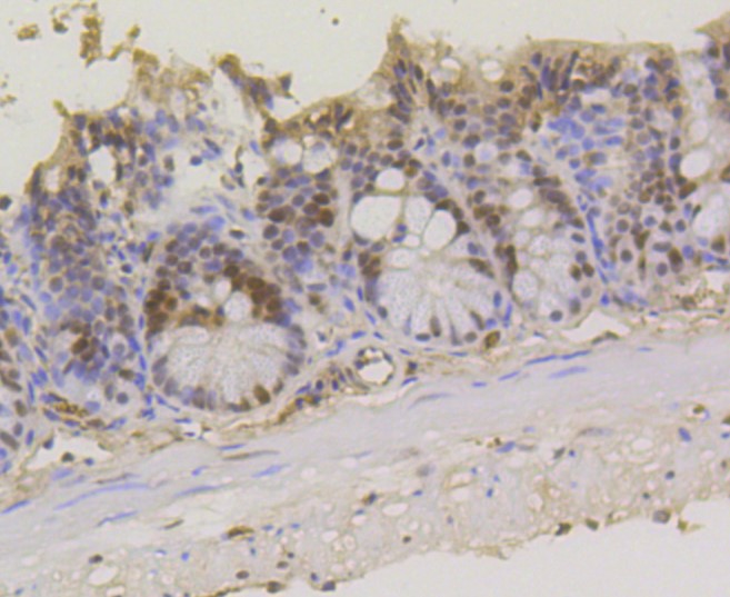 Paraformaldehyde-fixed and paraffin-embedded Mouse colon tissue incubated with ASH2L (1B6) Monoclonal Antibody (bsm-52448R) at 1:300, overnight at 4°C, followed by a conjugated secondary antibody and DAB staining. Counterstained with hematoxylin.