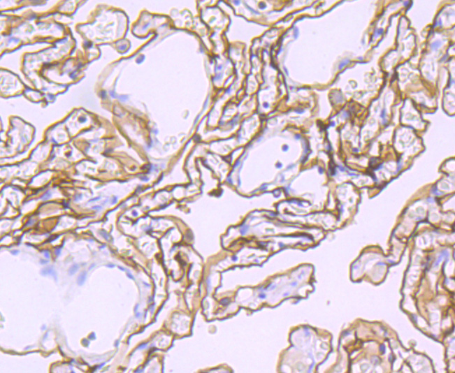 Paraformaldehyde-fixed and paraffin-embedded Human Lung tissue incubated with Podoplanin (3C3) Monoclonal Antibody (bsm-52936R) at 1:100, overnight at 4°C, followed by a conjugated secondary antibody and DAB staining. Counterstained with hematoxylin.