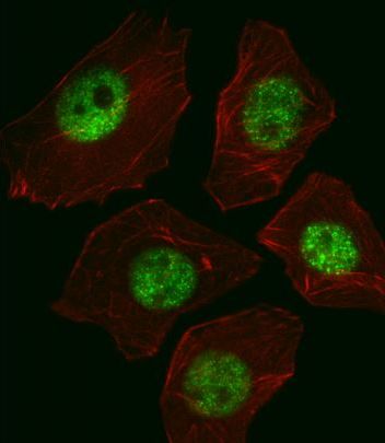 IF(ICC) staining with SOX2 (7C4) Monoclonal Antibody (bsm-51142M) at 1:50 (37\u2103 for 1hr) in A549 cells (green). Cells were counterstained with Alexa Fluor\u00ae 555 (red) conjugated Phalloidin. Cells were fixed in 4% paraformaldehyde for 20min and permeabilized with 0.1% Triton X100\/PBS for 10min.