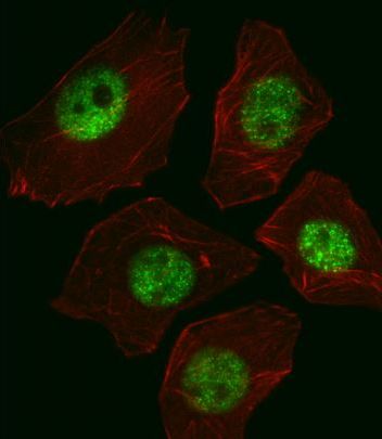 IF(ICC) staining with SOX2 (7C4) Monoclonal Antibody (bsm-51142M) at 1:50 (37℃ for 1hr) in A549 cells (green). Cells were counterstained with Alexa Fluor® 555 (red) conjugated Phalloidin. Cells were fixed in 4% paraformaldehyde for 20min and permeabilized with 0.1% Triton X100/PBS for 10min.