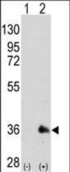 Lane 1: 293 Cells nontransfected; Lane 2: 293 Cells transiently transfected with SOX2 gene; Lane 3: Mouse Testis; Probed with SOX2 (7C4) Monoclonal Antibody (bsm-51142M) at 1:1000 overnight at 4°C followed by a conjugated secondary antibody for 60 minutes at 37°C.