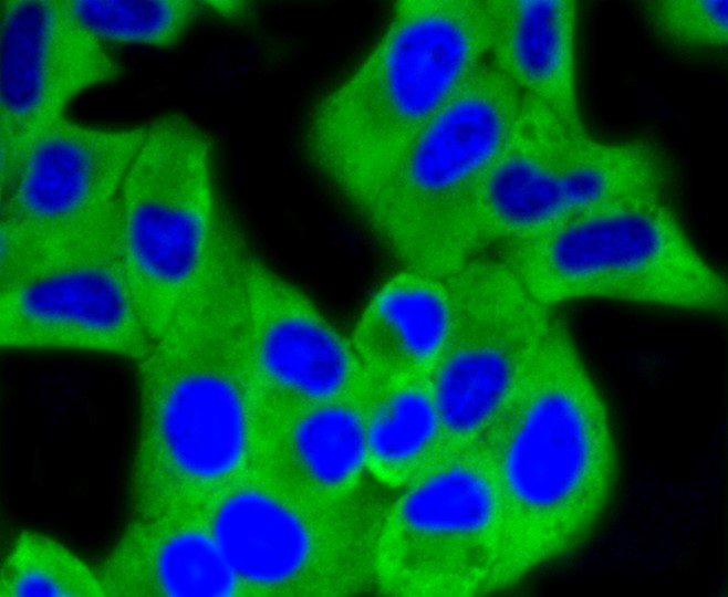 IF(ICC) staining with Hexokinase 1 (7B9) Monoclonal Antibody (bsm-52452R) at 1:100 in HeLa cells (green). The nuclear counterstain is DAPI (blue). Cells were fixed in paraformaldehyde, permeabilized with 0.25% Triton X100/PBS.