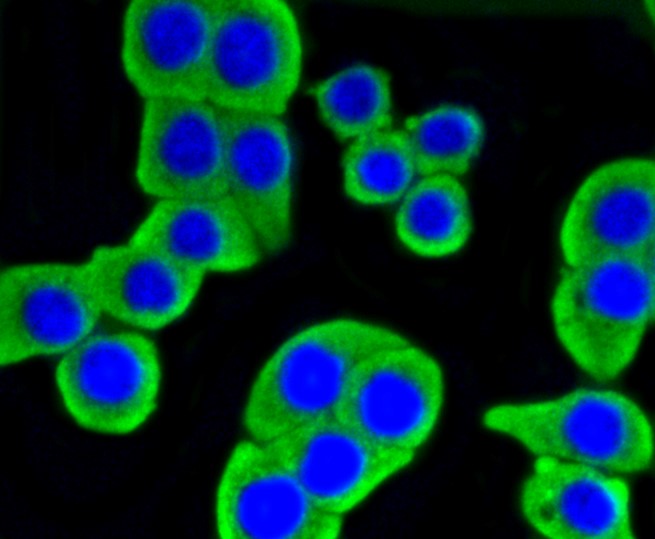 IF(ICC) staining with Hexokinase 1 (7B9) Monoclonal Antibody (bsm-52452R) at 1:100 in MCF-7 cells (green). The nuclear counterstain is DAPI (blue). Cells were fixed in paraformaldehyde, permeabilized with 0.25% Triton X100/PBS.