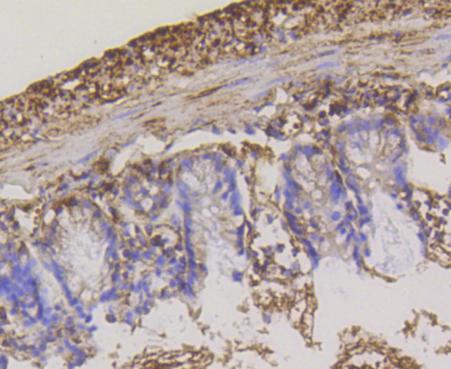 Paraformaldehyde-fixed and paraffin-embedded Mouse colon tissue incubated with Hexokinase 1 (7B9) Monoclonal Antibody (bsm-52452R) at 1:100, overnight at 4°C, followed by a conjugated secondary antibody and DAB staining. Counterstained with hematoxylin.