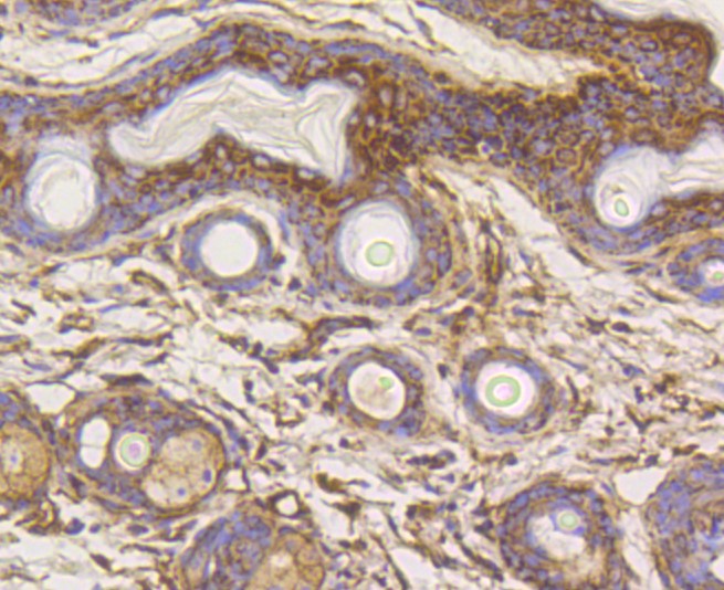 Paraformaldehyde-fixed and paraffin-embedded Mouse skin tissue incubated with Hexokinase 1 (7B9) Monoclonal Antibody (bsm-52452R) at 1:100, overnight at 4°C, followed by a conjugated secondary antibody and DAB staining. Counterstained with hematoxylin.