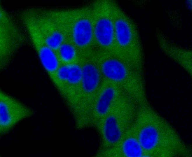 IF(ICC) staining with Dnmt3a (8A1) Monoclonal Antibody (bsm-52453R) at 1:100 in HeLa cells (green). The nuclear counterstain is DAPI (blue). Cells were fixed in paraformaldehyde, permeabilized with 0.25% Triton X100/PBS.
