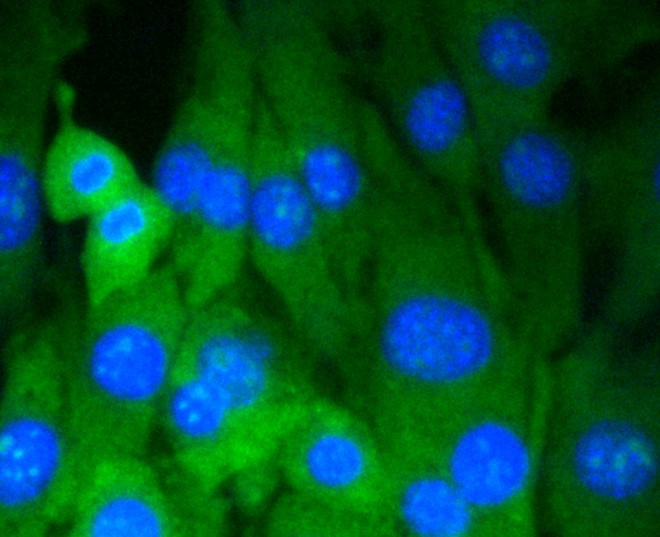 IF(ICC) staining with Dnmt3a (8A1) Monoclonal Antibody (bsm-52453R) at 1:100 in NIH/3T3 cells (green). The nuclear counterstain is DAPI (blue). Cells were fixed in paraformaldehyde, permeabilized with 0.25% Triton X100/PBS.