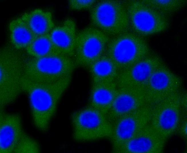 IF(ICC) staining with Dnmt3a (8A1) Monoclonal Antibody (bsm-52453R) at 1:100 in HepG2 cells (green). The nuclear counterstain is DAPI (blue). Cells were fixed in paraformaldehyde, permeabilized with 0.25% Triton X100/PBS.