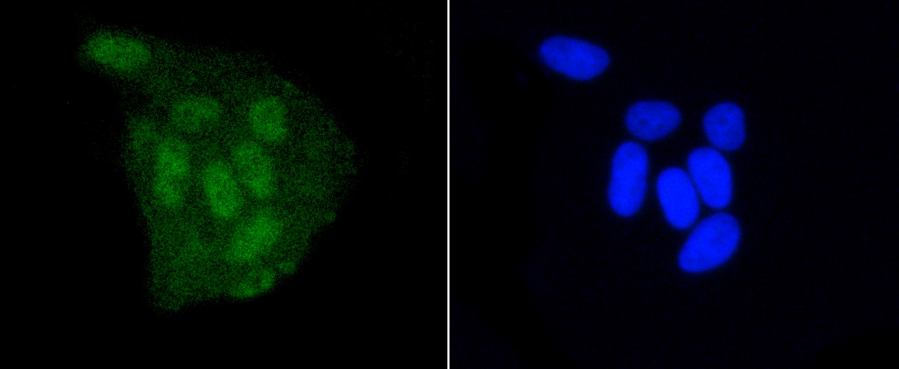 IF(ICC) staining with DGCR8 (3B11) Monoclonal Antibody (bsm-52454R) at 1:100 in HeLa cells (green). The nuclear counterstain is DAPI (blue). Cells were fixed in paraformaldehyde, permeabilized with 0.25% Triton X100/PBS.