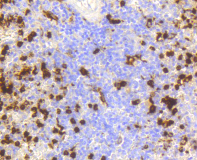 Paraformaldehyde-fixed and paraffin-embedded Human spleen tissue incubated with Lysozyme (3A11) Monoclonal Antibody (bsm-52456R) at 1:300, overnight at 4°C, followed by a conjugated secondary antibody and DAB staining. Counterstained with hematoxylin.