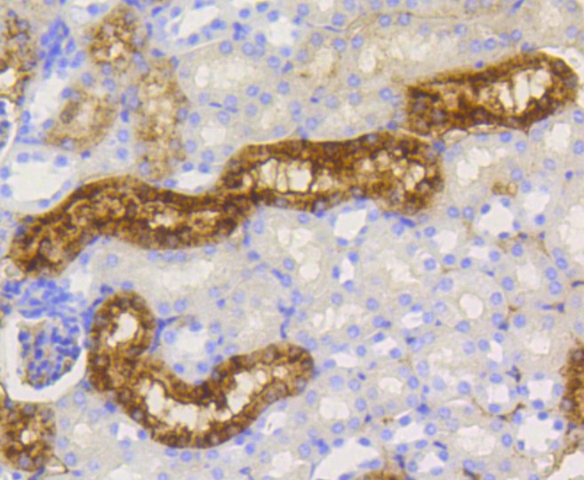 Paraformaldehyde-fixed and paraffin-embedded Mouse kidney tissue incubated with Lysozyme (3A11) Monoclonal Antibody (bsm-52456R) at 1:300, overnight at 4°C, followed by a conjugated secondary antibody and DAB staining. Counterstained with hematoxylin.