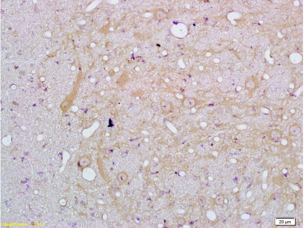 Formalin-fixed and paraffin embedded rat brain tissue labeled with Anti-IL-18 Polyclonal Antibody (bs-0529R), Unconjugated at 1:200, followed by conjugation to the secondary antibody and DAB staining Formalin-fixed and paraffin embedded rat brain tissue labeled with Anti-IL-18 Polyclonal Antibody (bs-0529R), Unconjugated at 1:200, followed by conjugation to the secondary antibody and DAB staining