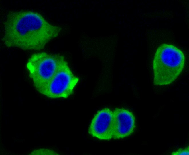 IF(ICC) staining with ATP citRate lyase (3G8) Monoclonal Antibody (bsm-52458R) at 1:100 in HeLa cells (green). The nuclear counterstain is DAPI (blue). Cells were fixed in paraformaldehyde, permeabilized with 0.25% Triton X100/PBS.