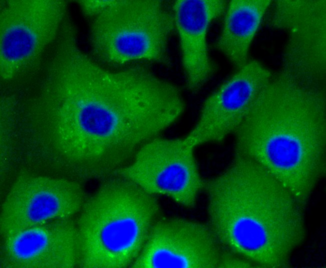 IF(ICC) staining with ATP citRate lyase (3G8) Monoclonal Antibody (bsm-52458R) at 1:100 in A549 cells (green). The nuclear counterstain is DAPI (blue). Cells were fixed in paraformaldehyde, permeabilized with 0.25% Triton X100/PBS.