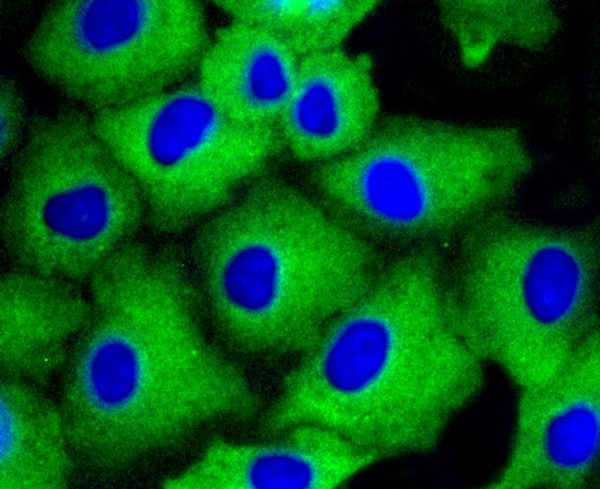 IF(ICC) staining with beta Arrestin 1 (3A11) Monoclonal Antibody (bsm-52459R) at 1:100 in A549 cells (green). The nuclear counterstain is DAPI (blue). Cells were fixed in paraformaldehyde, permeabilized with 0.25% Triton X100/PBS.