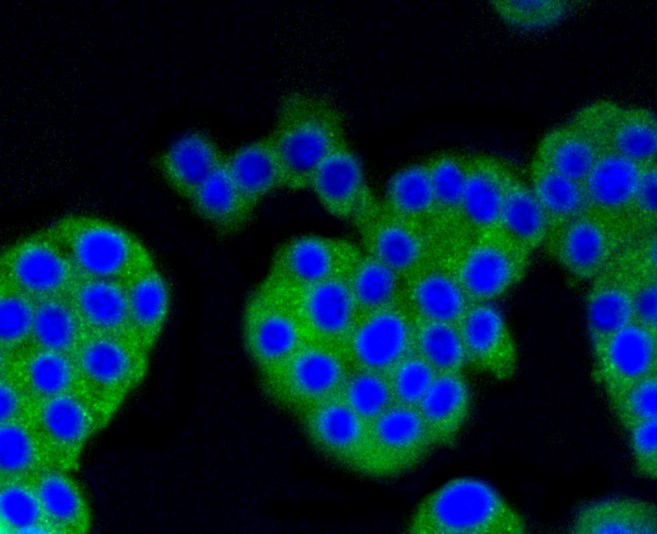 IF(ICC) staining with beta Arrestin 1 (3A11) Monoclonal Antibody (bsm-52459R) at 1:100 in PC-12 cells (green). The nuclear counterstain is DAPI (blue). Cells were fixed in paraformaldehyde, permeabilized with 0.25% Triton X100/PBS.