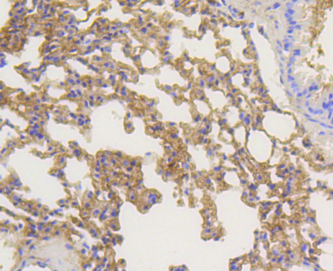 Paraformaldehyde-fixed and paraffin-embedded Mouse lung tissue incubated with beta Arrestin 1 (3A11) Monoclonal Antibody (bsm-52459R) at 1:100, overnight at 4°C, followed by a conjugated secondary antibody and DAB staining. Counterstained with hematoxylin.