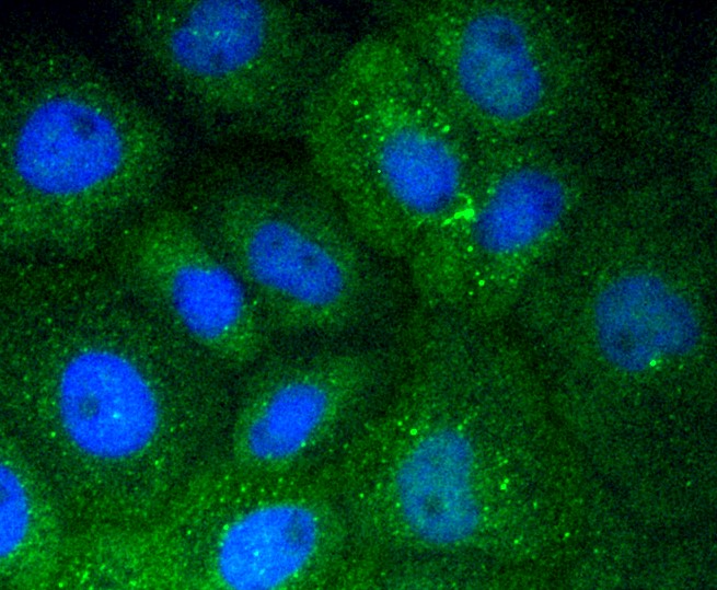 IF(ICC) staining with Vitronectin (7A1) Monoclonal Antibody (bsm-52460R) at 1:100 in A431 cells (green). The nuclear counterstain is DAPI (blue). Cells were fixed in paraformaldehyde, permeabilized with 0.25% Triton X100/PBS.