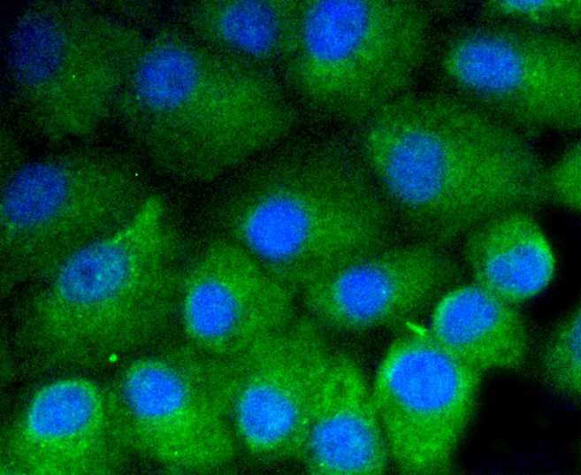 IF(ICC) staining with Vitronectin (7A1) Monoclonal Antibody (bsm-52460R) at 1:100 in A549 cells (green). The nuclear counterstain is DAPI (blue). Cells were fixed in paraformaldehyde, permeabilized with 0.25% Triton X100/PBS.