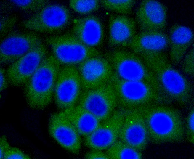 IF(ICC) staining with Vitronectin (7A1) Monoclonal Antibody (bsm-52460R) at 1:100 in HepG2 cells (green). The nuclear counterstain is DAPI (blue). Cells were fixed in paraformaldehyde, permeabilized with 0.25% Triton X100/PBS.