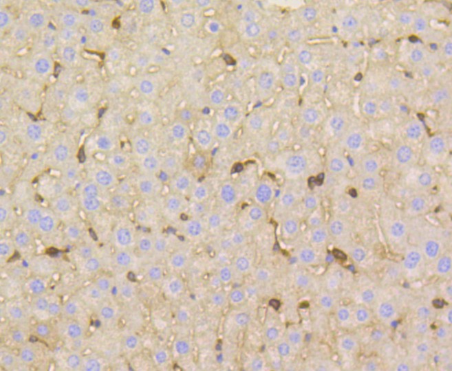 Paraformaldehyde-fixed and paraffin-embedded Mouse liver tissue incubated with Vitronectin (7A1) Monoclonal Antibody (bsm-52460R) at 1:100, overnight at 4°C, followed by a conjugated secondary antibody and DAB staining. Counterstained with hematoxylin.