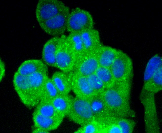 IF(ICC) staining with Vitronectin (7A1) Monoclonal Antibody (bsm-52460R) at 1:100 in MCF-7 cells (green). The nuclear counterstain is DAPI (blue). Cells were fixed in paraformaldehyde, permeabilized with 0.25% Triton X100/PBS.