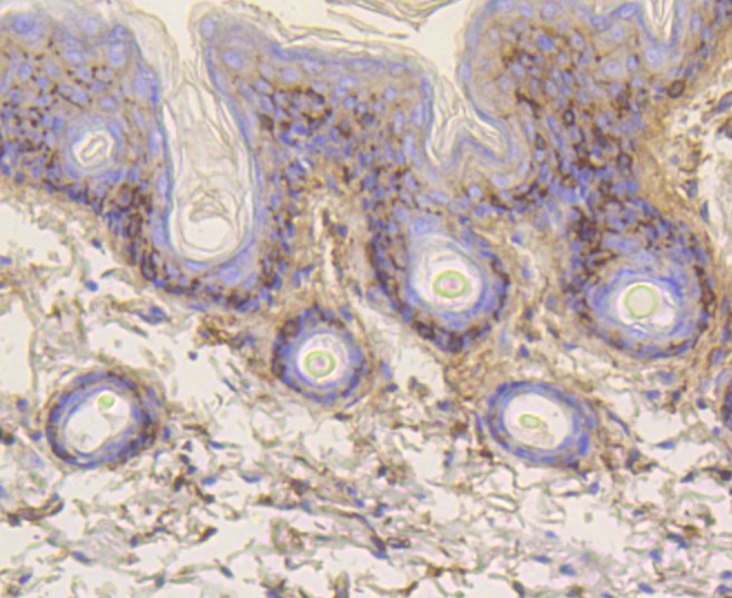 Paraformaldehyde-fixed and paraffin-embedded Mouse skin tissue incubated with Vitronectin (7A1) Monoclonal Antibody (bsm-52460R) at 1:100, overnight at 4°C, followed by a conjugated secondary antibody and DAB staining. Counterstained with hematoxylin.