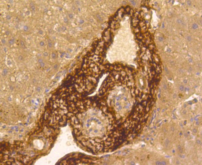 Paraformaldehyde-fixed and paraffin-embedded Human liver tissue incubated with Vitronectin (7A1) Monoclonal Antibody (bsm-52460R) at 1:100, overnight at 4°C, followed by a conjugated secondary antibody and DAB staining. Counterstained with hematoxylin.