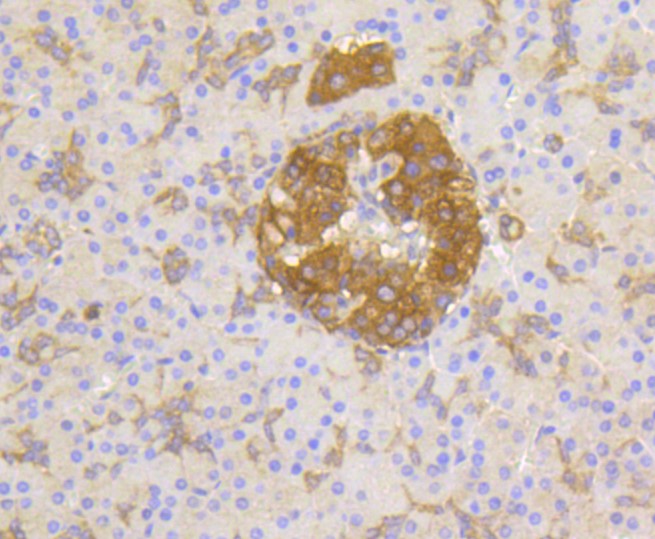 Paraformaldehyde-fixed and paraffin-embedded Human pancreas tissue incubated with PP2A (Y307) (29A1) Monoclonal Antibody (bsm-52461R) at 1:100, overnight at 4°C, followed by a conjugated secondary antibody and DAB staining. Counterstained with hematoxylin.