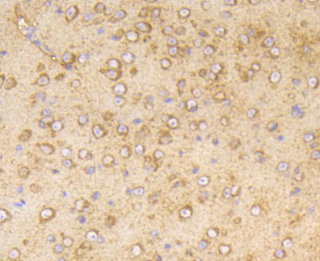 Paraformaldehyde-fixed and paraffin-embedded Mouse brain tissue incubated with PP2A (Y307) (29A1) Monoclonal Antibody (bsm-52461R) at 1:100, overnight at 4°C, followed by a conjugated secondary antibody and DAB staining. Counterstained with hematoxylin.