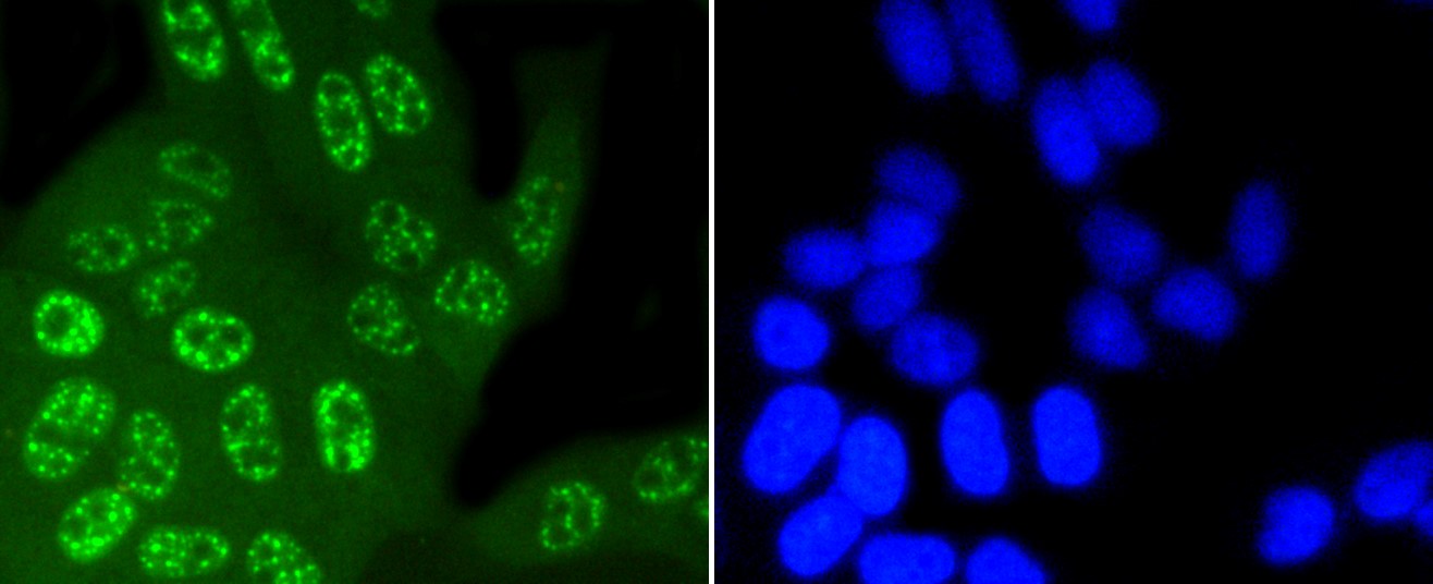 IF(ICC) staining with Phospho-JNK1/2/3 (T183+T183+T221) (6C10) Monoclonal Antibody (bsm-52462R) at 1:100 in HeLa cells (green). The nuclear counterstain is DAPI (blue). Cells were fixed in paraformaldehyde, permeabilized with 0.25% Triton X100/PBS.