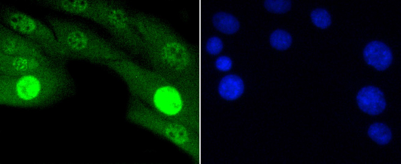 IF(ICC) staining with Phospho-JNK1/2/3 (T183+T183+T221) (6C10) Monoclonal Antibody (bsm-52462R) at 1:100 in NIH/3T3 cells (green). The nuclear counterstain is DAPI (blue). Cells were fixed in paraformaldehyde, permeabilized with 0.25% Triton X100/PBS.