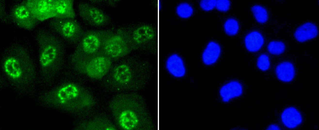 IF(ICC) staining with Phospho-JNK1/2/3 (T183+T183+T221) (6C10) Monoclonal Antibody (bsm-52462R) at 1:100 in HUVEC cells (green). The nuclear counterstain is DAPI (blue). Cells were fixed in paraformaldehyde, permeabilized with 0.25% Triton X100/PBS.