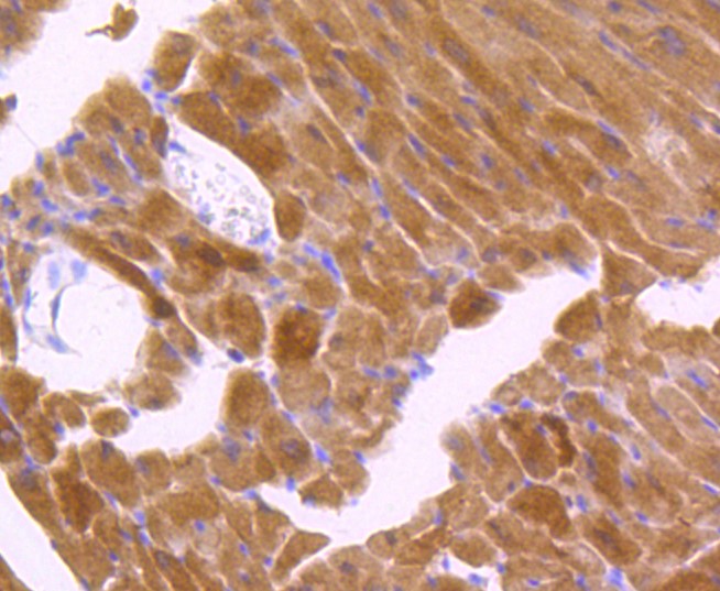 Paraformaldehyde-fixed and paraffin-embedded Mouse heart tissue incubated with Phospho-JNK1/2/3 (T183+T183+T221) (6C10) Monoclonal Antibody (bsm-52462R) at 1:100, overnight at 4°C, followed by a conjugated secondary antibody and DAB staining. Counterstained with hematoxylin.