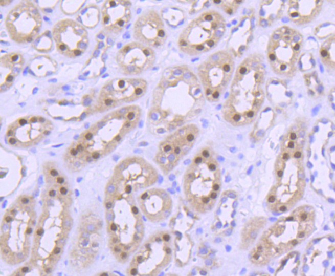 Paraformaldehyde-fixed and paraffin-embedded Human kidney tissue incubated with PRMT5 (28A3) Monoclonal Antibody (bsm-52463R) at 1:100, overnight at 4°C, followed by a conjugated secondary antibody and DAB staining. Counterstained with hematoxylin.