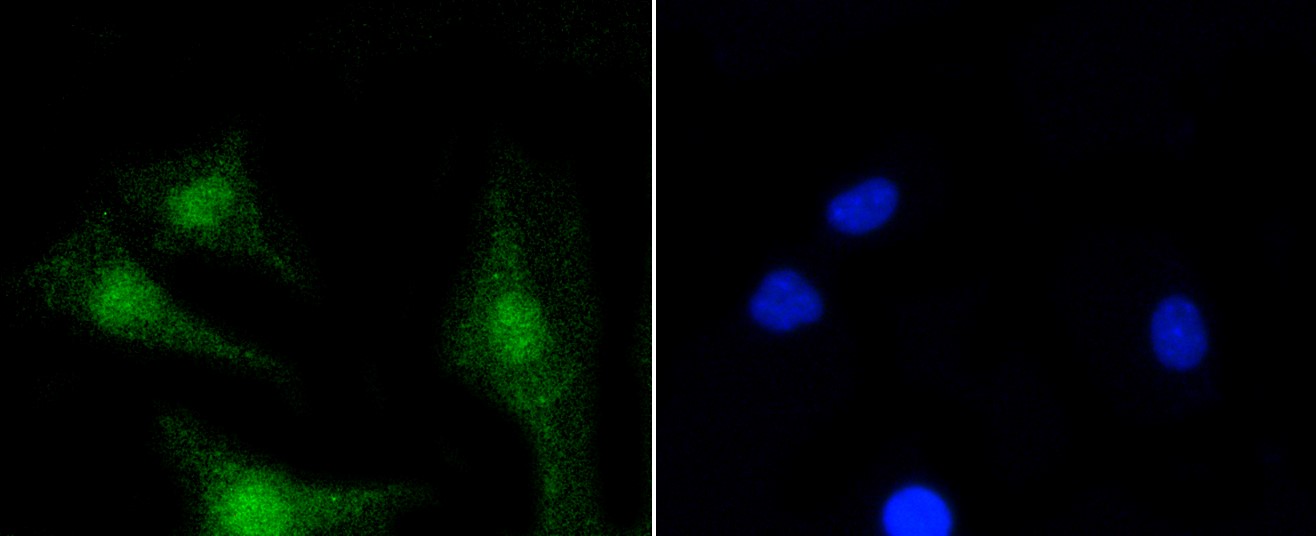 IF(ICC) staining with PKC beta 2 (10A1) Monoclonal Antibody (bsm-52464R) at 1:100 in SH-SY5Y cells (green). The nuclear counterstain is DAPI (blue). Cells were fixed in paraformaldehyde, permeabilized with 0.25% Triton X100/PBS.