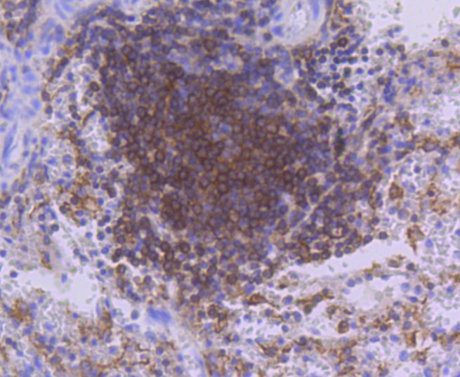 Paraformaldehyde-fixed and paraffin-embedded Human spleen tissue incubated with PKC beta 2 (10A1) Monoclonal Antibody (bsm-52464R) at 1:100, overnight at 4°C, followed by a conjugated secondary antibody and DAB staining. Counterstained with hematoxylin.