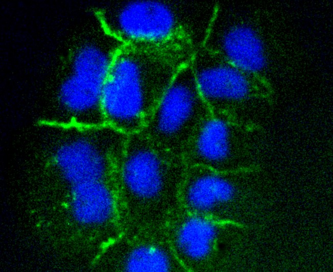 IF(ICC) staining with ICAM1 (1G2) Monoclonal Antibody (bsm-52466R) at 1:100 in A431 cells (green). The nuclear counterstain is DAPI (blue). Cells were fixed in paraformaldehyde, permeabilized with 0.25% Triton X100/PBS.