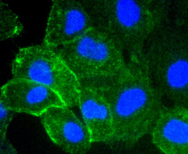 IF(ICC) staining with ICAM1 (1G2) Monoclonal Antibody (bsm-52466R) at 1:100 in HUVEC cells (green). The nuclear counterstain is DAPI (blue). Cells were fixed in paraformaldehyde, permeabilized with 0.25% Triton X100/PBS.