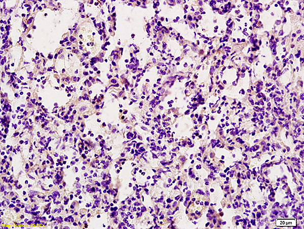 Formalin-fixed and paraffin embedded rat lung labeled with Anti-TRAIL Polyclonal Antibody, Unconjugated (bs-1214R) at 1:200 followed by conjugation to the secondary antibody and DAB staining.