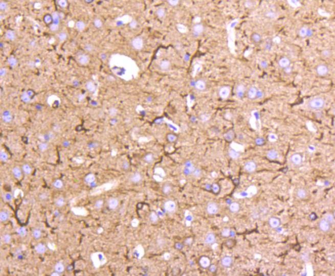 Paraformaldehyde-fixed and paraffin-embedded Mouse brain tissue incubated with ICAM1 (1G2) Monoclonal Antibody (bsm-52466R) at 1:100, overnight at 4°C, followed by a conjugated secondary antibody and DAB staining. Counterstained with hematoxylin.