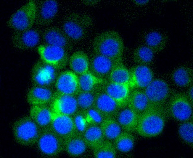 IF(ICC) staining with beta Ⅱ Tubulin (48D2) Monoclonal Antibody (bsm-52467R) at 1:100 in N2A cells (green). The nuclear counterstain is DAPI (blue). Cells were fixed in paraformaldehyde, permeabilized with 0.25% Triton X100/PBS.