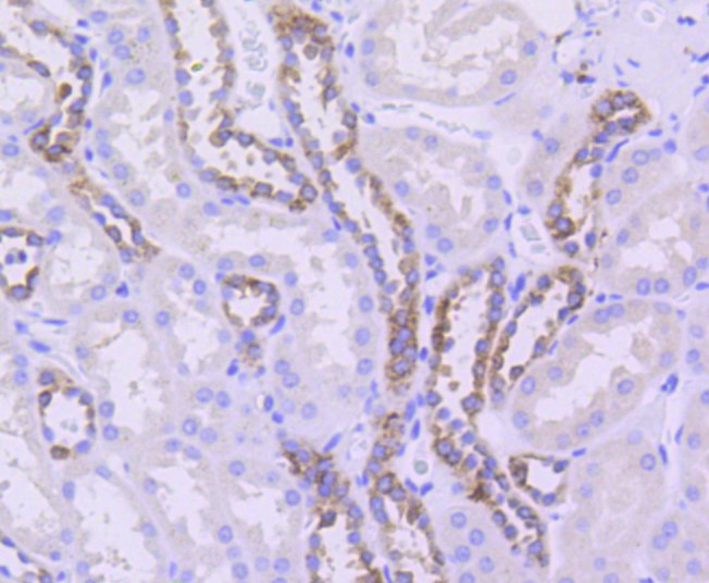 Paraformaldehyde-fixed and paraffin-embedded Human kidney tissue incubated with beta Ⅱ Tubulin (48D2) Monoclonal Antibody (bsm-52467R) at 1:100, overnight at 4°C, followed by a conjugated secondary antibody and DAB staining. Counterstained with hematoxylin.
