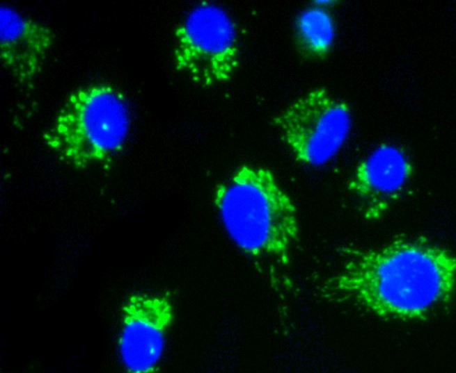 IF(ICC) staining with AKT1/2/3 (35B2) Monoclonal Antibody (bsm-52468R) at 1:100 in A549 cells (green). The nuclear counterstain is DAPI (blue). Cells were fixed in paraformaldehyde, permeabilized with 0.25% Triton X100/PBS.