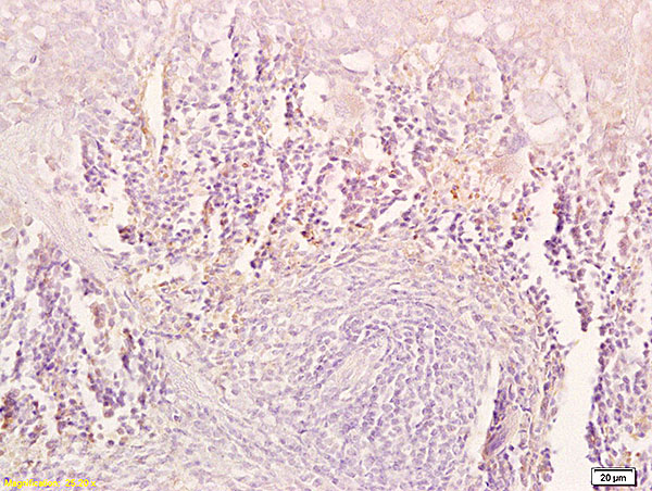 Formalin-fixed and paraffin embedded mouse spleen tissue labeled with Anti-TRAIL Polyclonal Antibody, Unconjugated (bs-1214R) at 1:200 followed by conjugation to the secondary antibody and DAB staining.