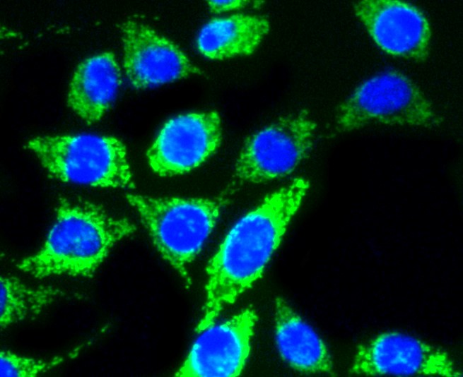 IF(ICC) staining with AKT1/2/3 (35B2) Monoclonal Antibody (bsm-52468R) at 1:100 in SH-SY5Y cells (green). The nuclear counterstain is DAPI (blue). Cells were fixed in paraformaldehyde, permeabilized with 0.25% Triton X100/PBS.