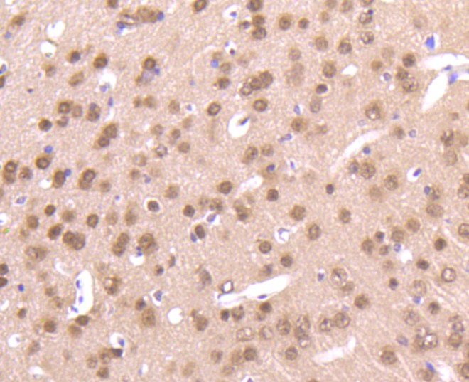 Paraformaldehyde-fixed and paraffin-embedded Mouse brain tissue incubated with AKT1/2/3 (35B2) Monoclonal Antibody (bsm-52468R) at 1:100, overnight at 4°C, followed by a conjugated secondary antibody and DAB staining. Counterstained with hematoxylin.