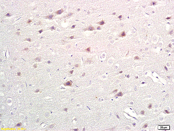 Formalin-fixed and paraffin embedded rat brain labeled with Anti-TPH/Trptophan Hydroxylase Polyclonal Antibody, Unconjugated (bs-1215R) at 1:200 followed by conjugation to the secondary antibody and DAB staining.