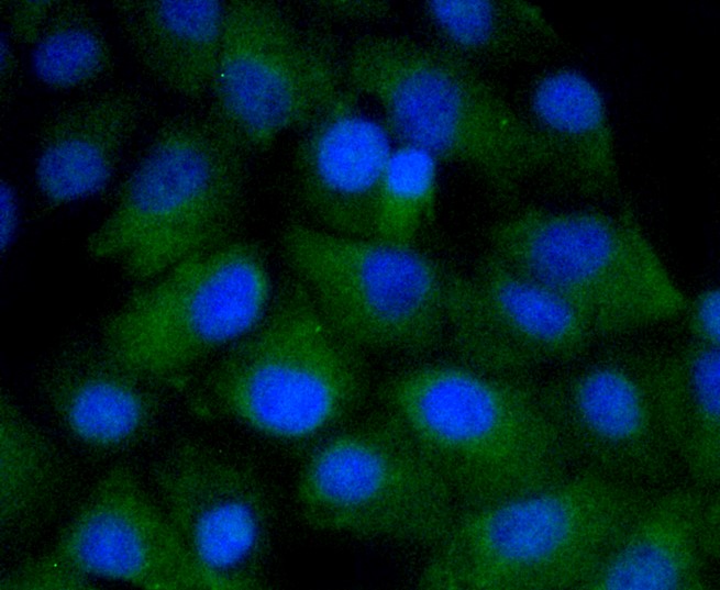 IF(ICC) staining with CD4 (65H6) Monoclonal Antibody (bsm-52469R) at 1:100 in A549 cells (green). The nuclear counterstain is DAPI (blue). Cells were fixed in paraformaldehyde, permeabilized with 0.25% Triton X100/PBS.